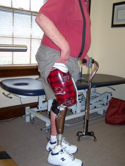 Lyons Prosthetics Genium knee prosthesis in Myrtle Beach